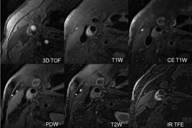 Multicontrast MRI image.