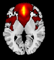 Brain scan.