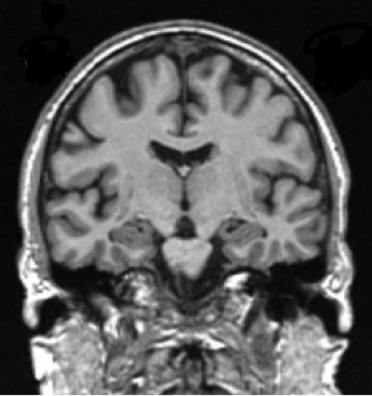Brain MRI.