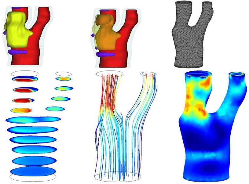 CFD.