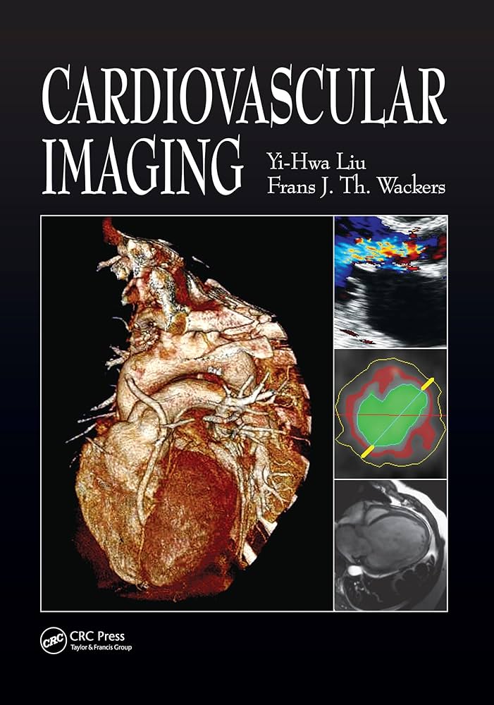 Cover of Cardiovascular Imaging journal.