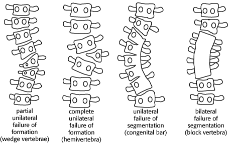 Congenital.