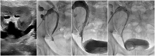 Genitourinary-Interventions.