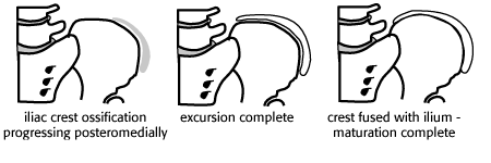 Iliac Crest.