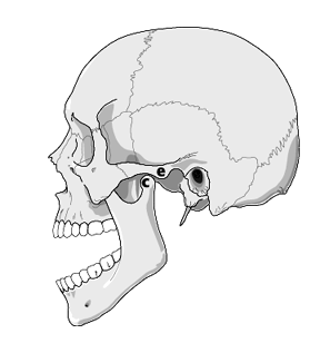 Mandible Dislocation.