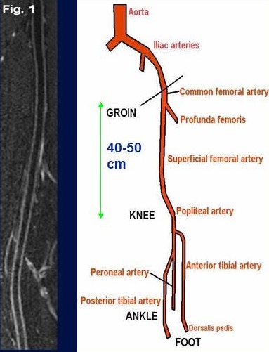 Femoral artery.