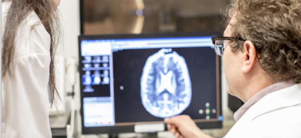 Doctor looking at brain scan.