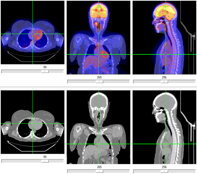 PET/CT image.