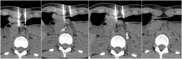 Pain and Palliation Interventions.