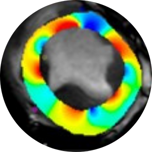 Heart scan.