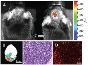 Brain image with pathology correlation.