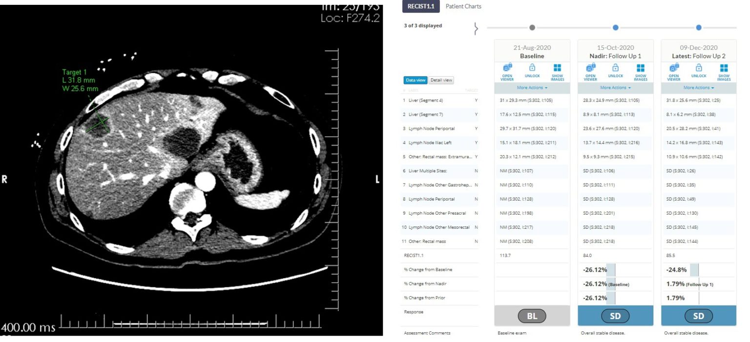 Oncorad text and abdominal CT.