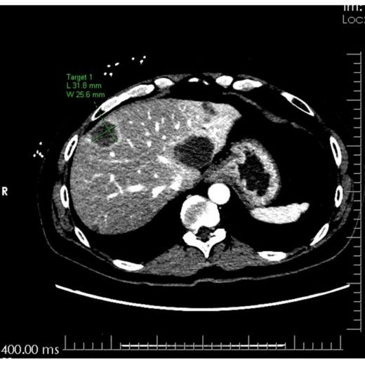 Abdominal scan.