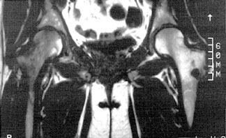 TOH MRI.