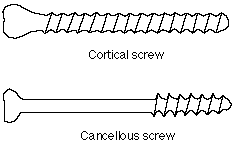 Two Screws.