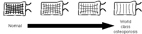 Vertebra Trabeculae.