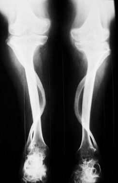 Weird JRA Legs.