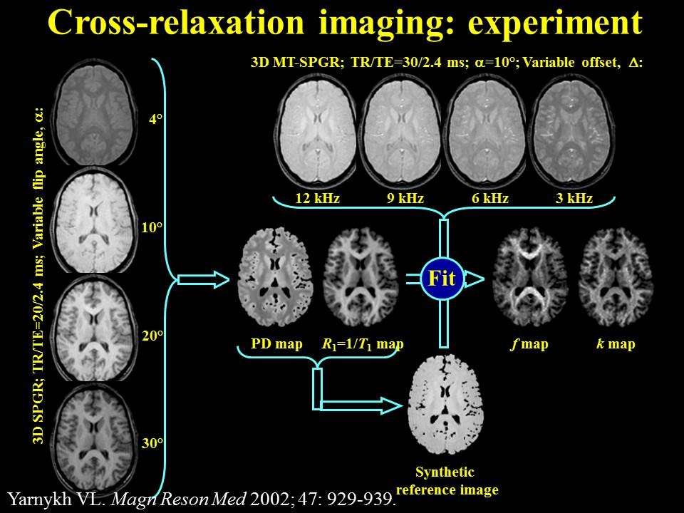 Cross relaxation imaging.