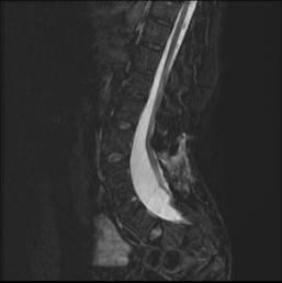 T2 Sagittal.