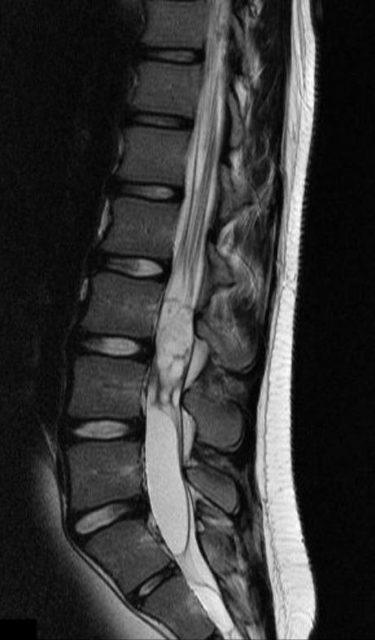 T2 sagittal.