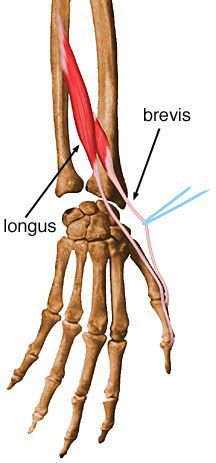 Extensor pollicis longus.