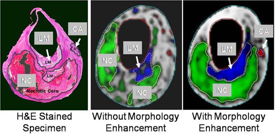 Color enhanced CT.