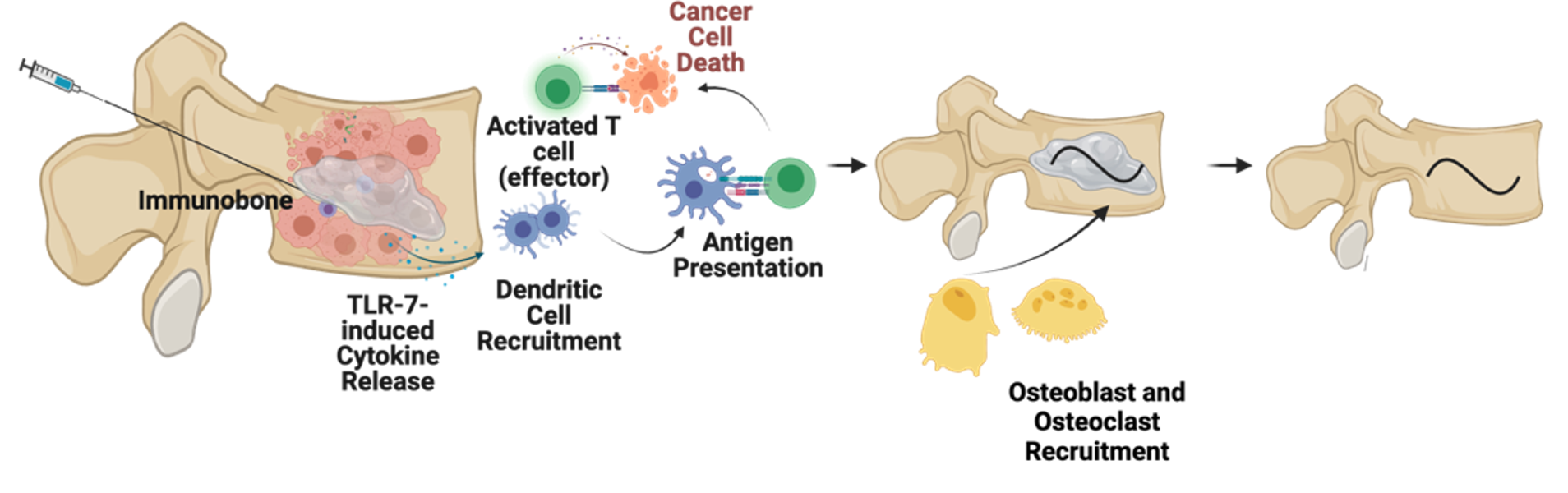 Immunobone.