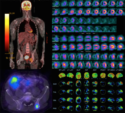 PET scan.