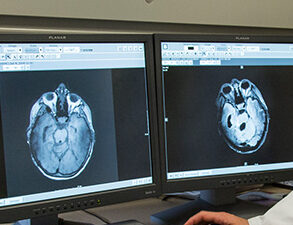 Brain PET.