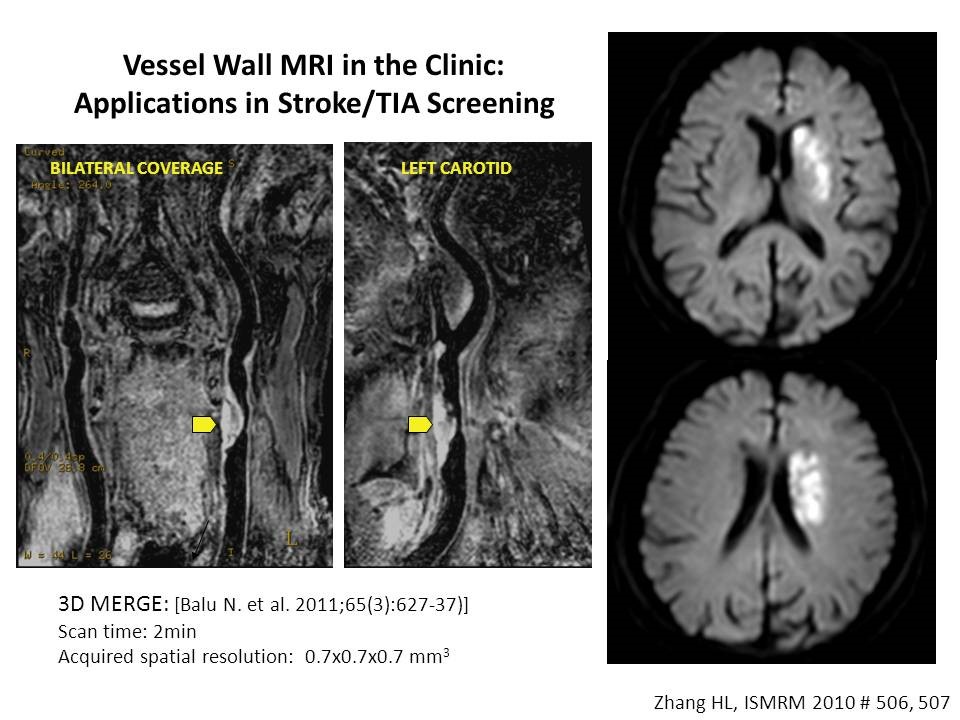 Stroke on 3D MERGE.
