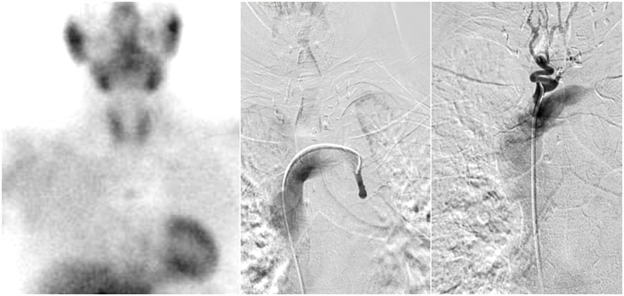 Venous Samplings Image 2 of 2.