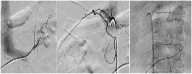 Venous Samplings Image 1 of 2.
