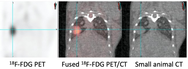 FDG PET/CT.
